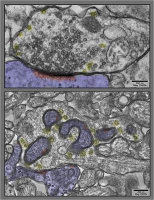 The Structural Basis of Long-Term Potentiation in Hippocampal Synapses, Revealed by Electron Microscopy Imaging of Lanthanum-Induced Synaptic Vesicle Recycling